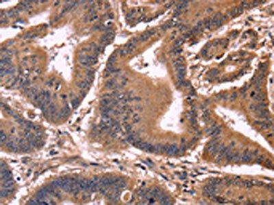 CCDC106 antibody