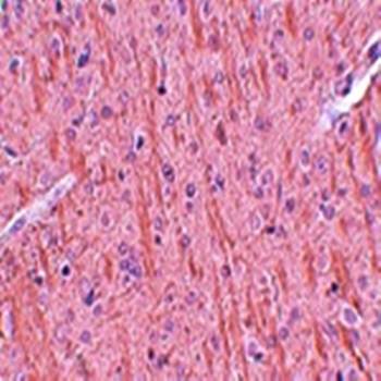 CCDC106 Antibody