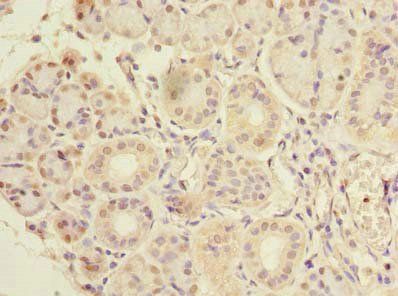 CFAP65 Antibody