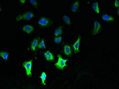MCUB Antibody