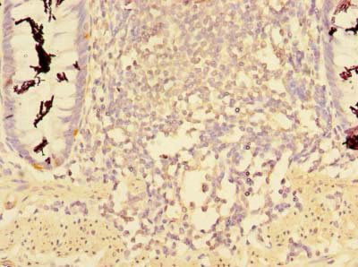 CCDC112 Antibody