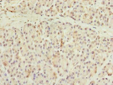 CCDC116 Antibody