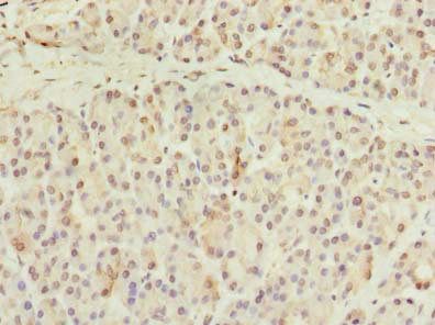 CCDC116 antibody