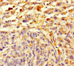 CCDC184 Antibody