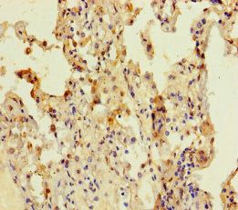CCDC184 Antibody