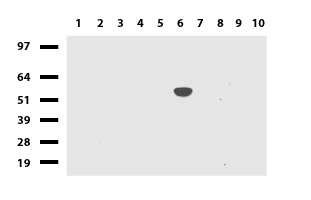 CCDC22 Antibody