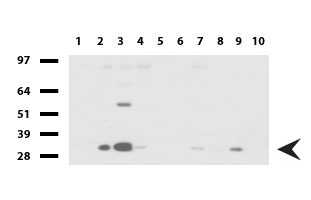 CCDC22 Antibody