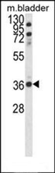 CCDC3 antibody