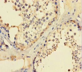 CCDC36 Antibody