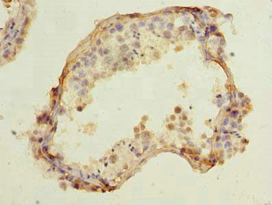 CCDC42 Antibody