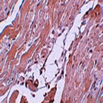 CCDC47 Antibody