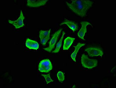 CCDC6 Antibody