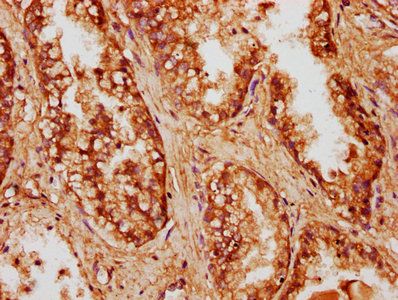 CCDC6 Antibody
