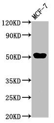 CCDC6 Antibody