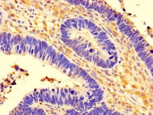 CCDC91 Antibody