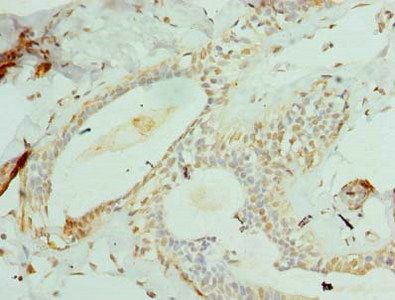 CCDC97 Antibody