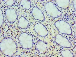 CCK Antibody