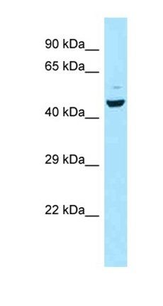 CCKAR antibody