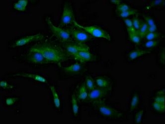 CCKAR Antibody