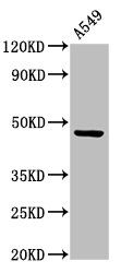 CCKAR antibody