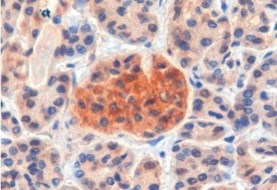 Goat anti-CCKBR Antibody