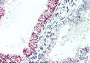Goat anti-CCKBR Antibody