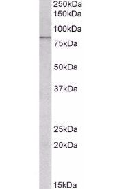 Goat anti-CCKBR Antibody