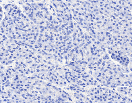 Goat anti-CCKBR Antibody