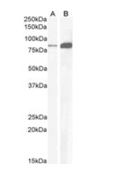Goat anti-CCKBR Antibody