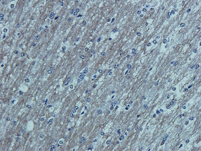 CCKN antibody