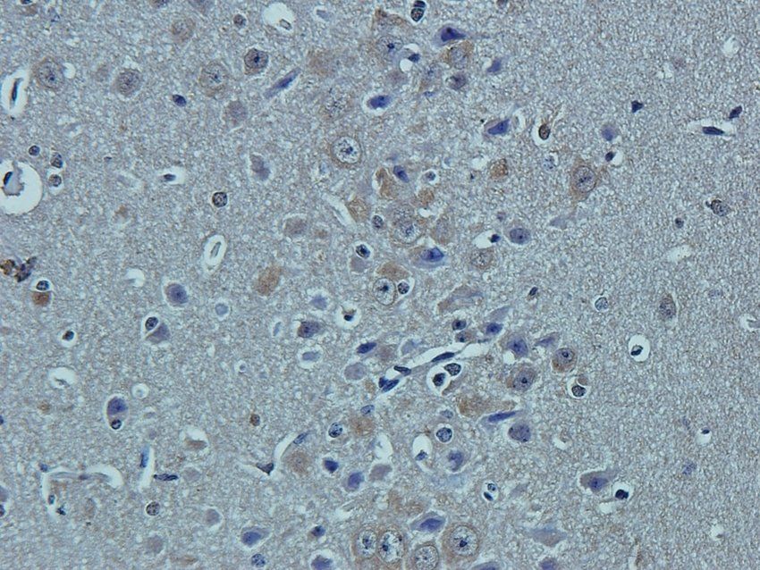 CCKN antibody