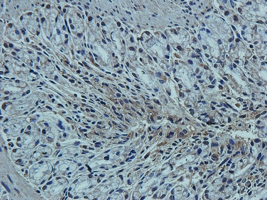 CCKN antibody