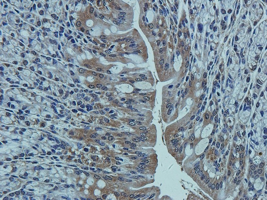 CCKN antibody