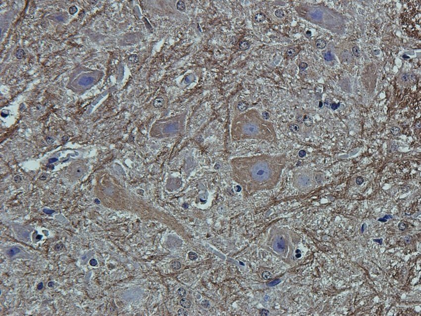 CCKN antibody