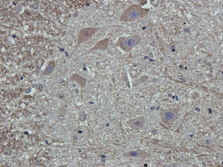 CCKN antibody