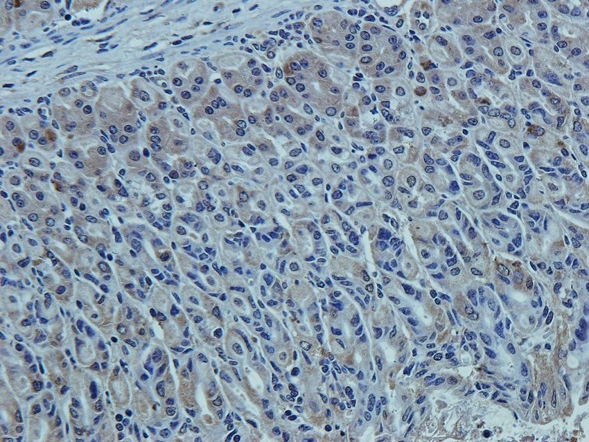 CCKN antibody