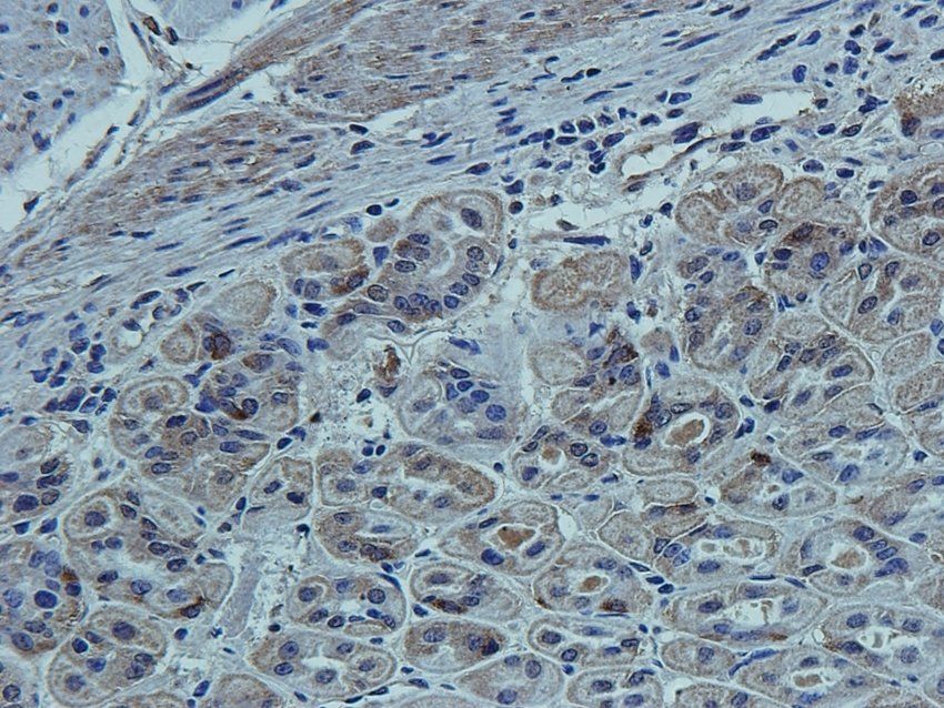 CCKN antibody