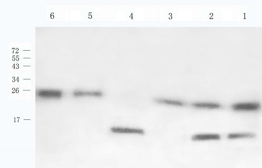 CCKN antibody