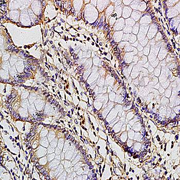 CCL1 precursor Rabbit Polyclonal Antibody