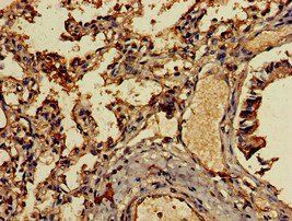 CCL13 Antibody