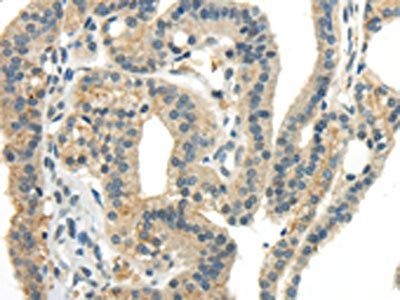 CCL13 Antibody