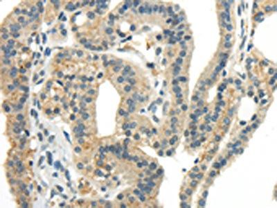 CCL13 antibody