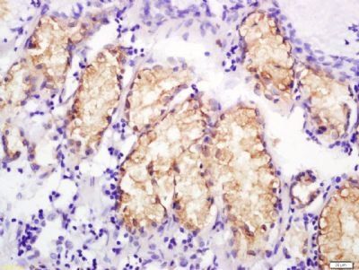 MCP4 Rabbit Polyclonal Antibody