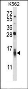 CCL15 antibody
