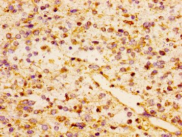 CCL17 Antibody