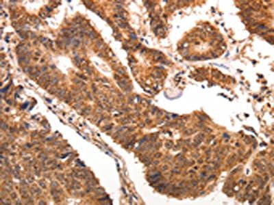 CCL17 Antibody