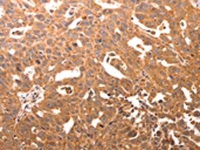 CCL17 Antibody