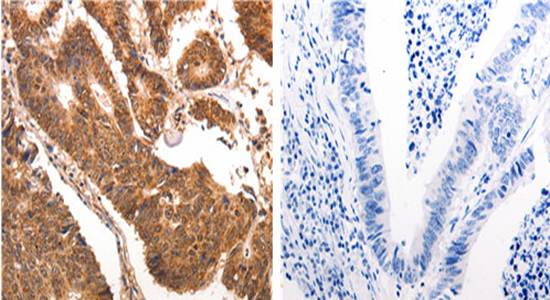 CCL17 Antibody