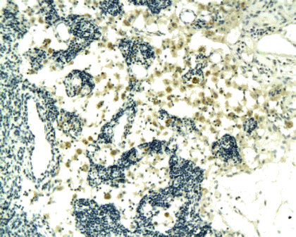 CCL17 Rabbit Polyclonal Antibody