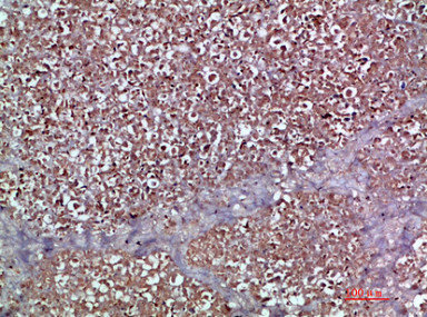 CCL20 antibody